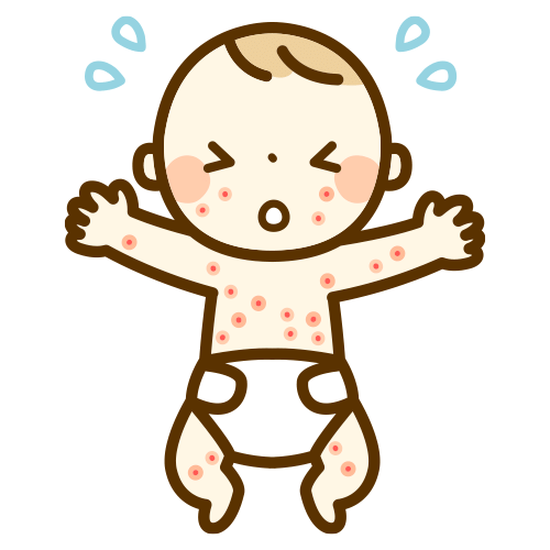 アトピー性皮膚炎